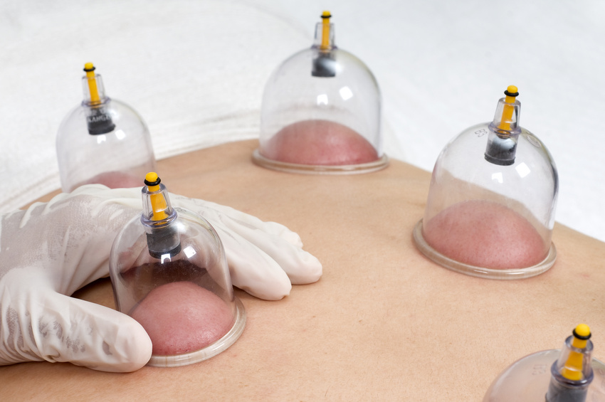 Hijama Therapy Course